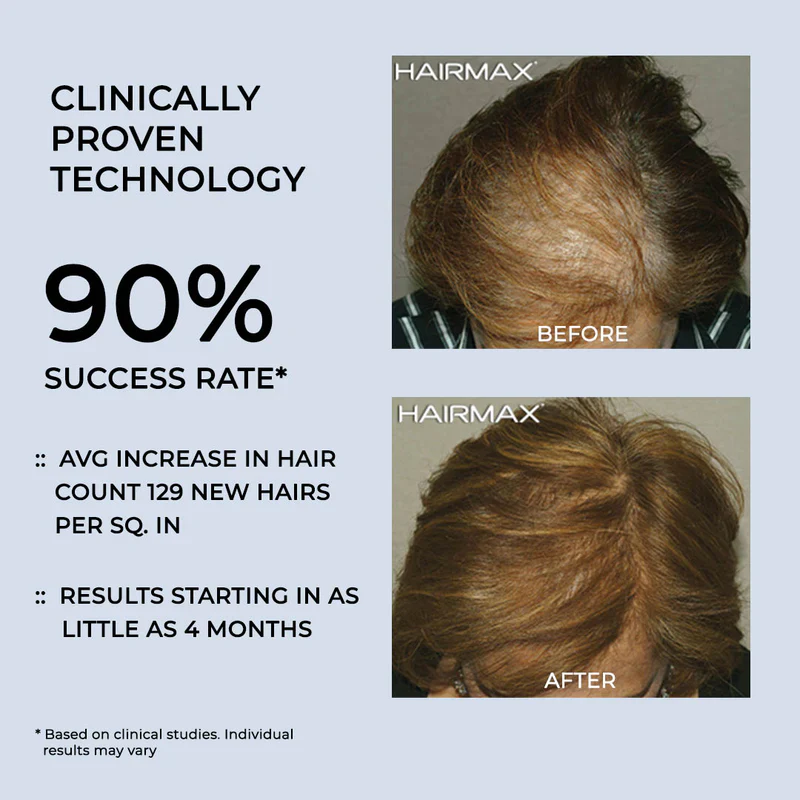 Hairmax LaserBand 82 ComfortFlex - Image 8