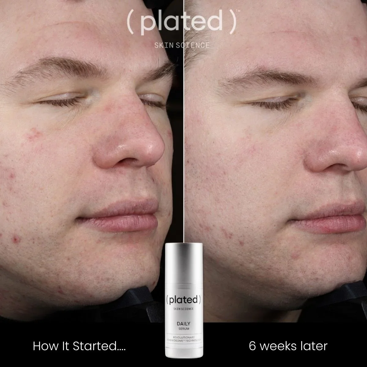 Plated Skin Science DAILY Serum Full Size - Image 3
