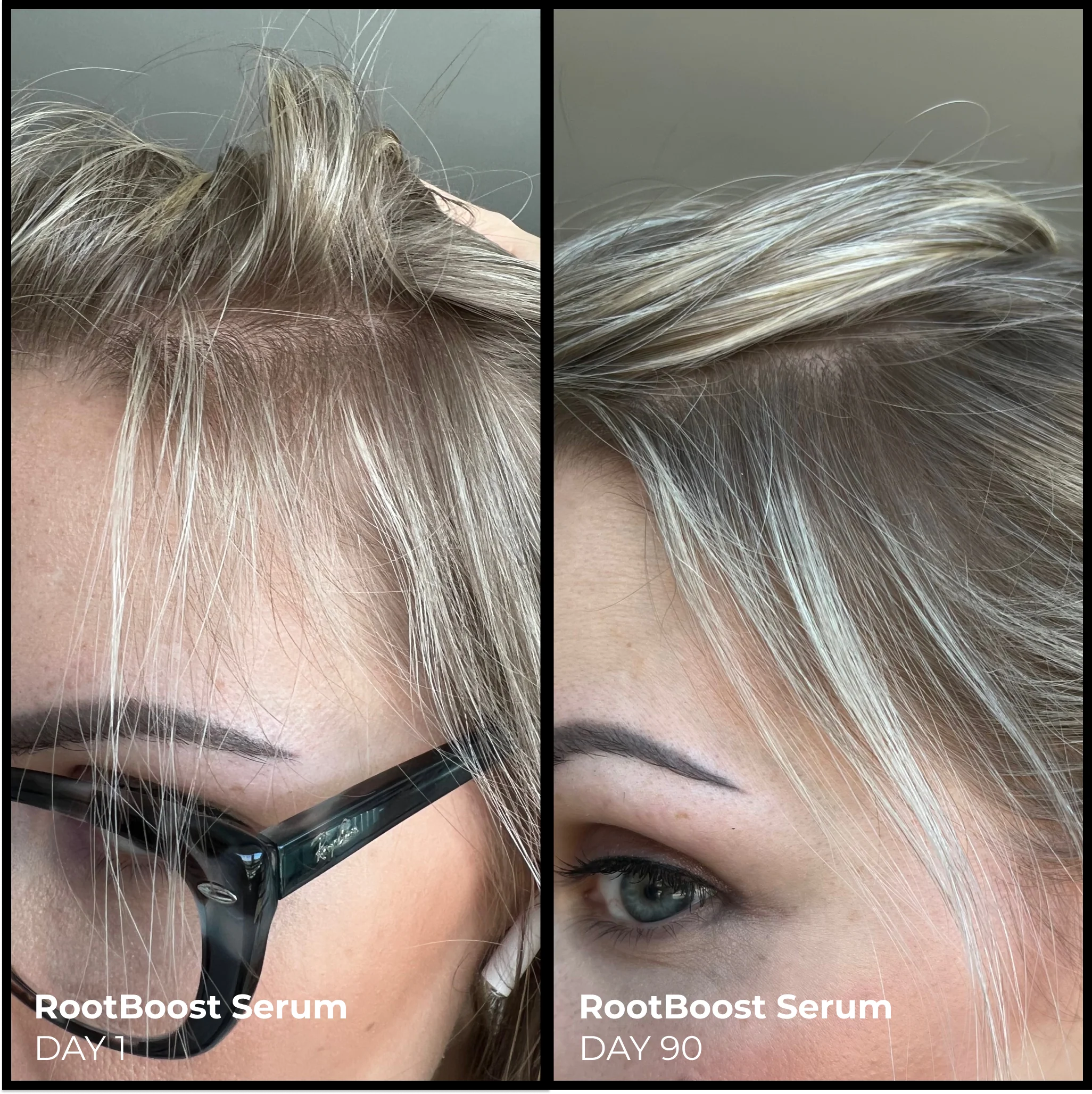 Better Roots RootBoost Serum - Image 6